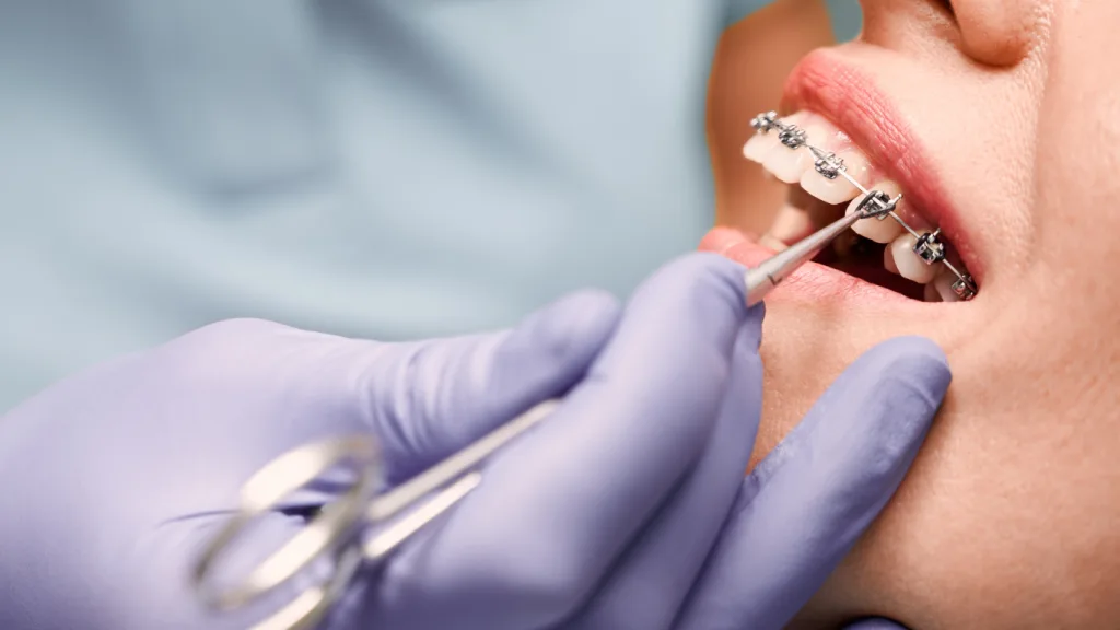 Лендінг для ортодонта