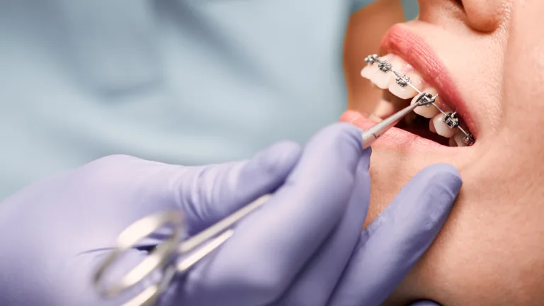 Лендінг для ортодонта